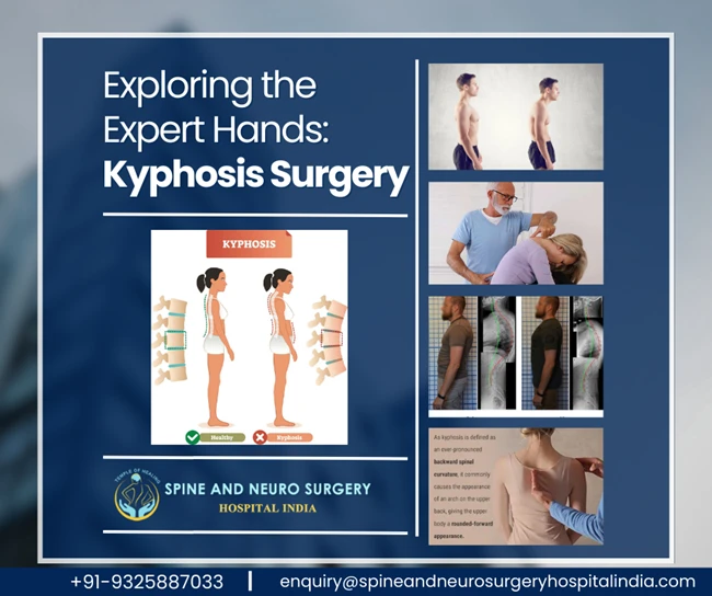Kyphosis Treatment