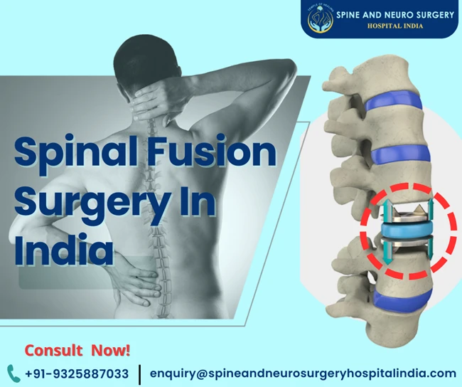 Top Hospitals for Spinal Fusion